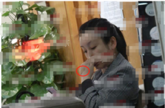 41���غ������ҽԺС��¡���ɻ���̥ �Ϲ�ȫ�̺ǻ�